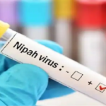 Nipah virus से केरल में एक युवक की मौत, जानें इस वायरस के लक्षण और बचाव के तरीके