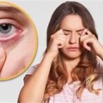 प्रदूषण का आंखों पर असर: जलन और खुजली से बढ़ी लोगों की परेशानी